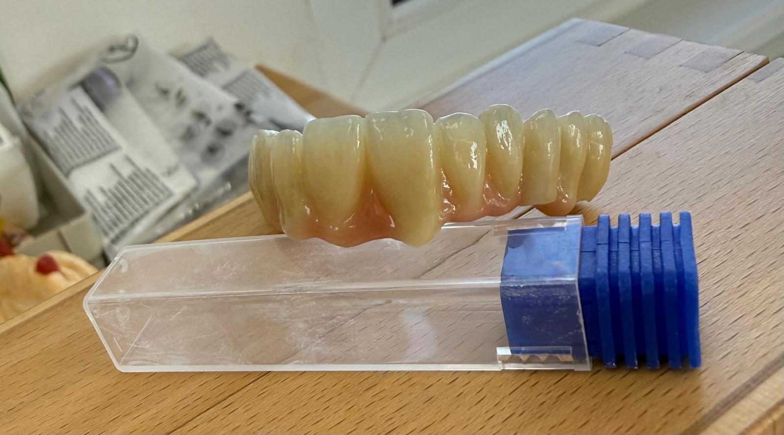 GM 2 Gradient ML - Für höchste Ästhetik im Frontzahnbereich