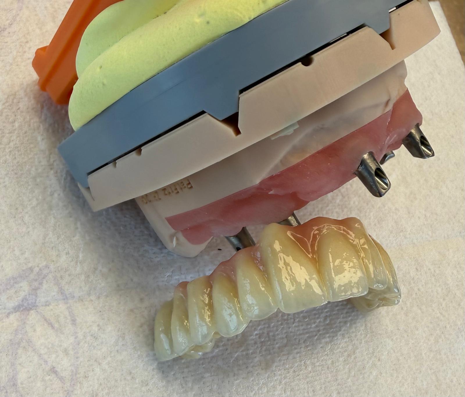 GM 2 Gradient ML - Für höchste Ästhetik im Frontzahnbereich
