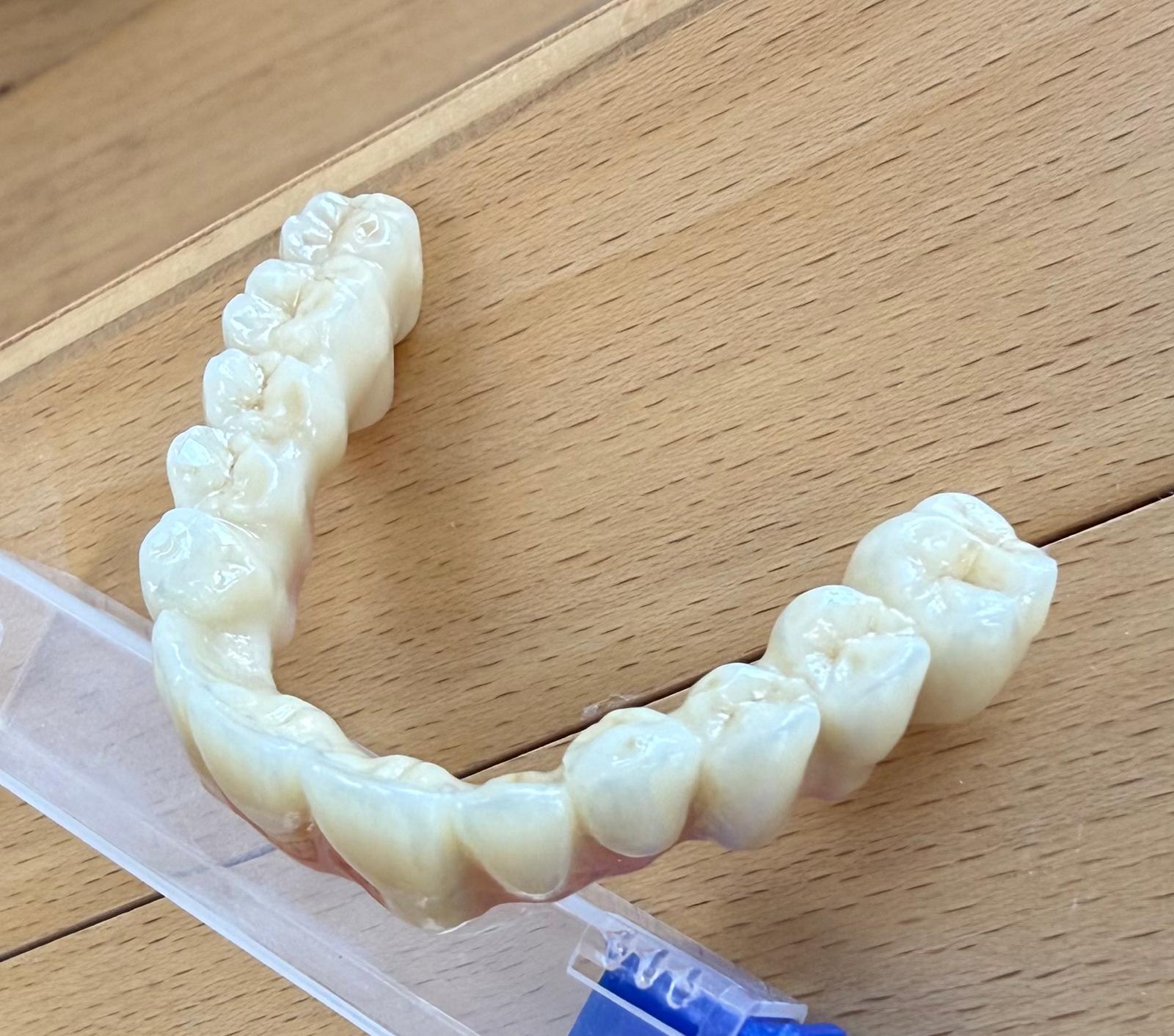 GM 2 Gradient ML - Für höchste Ästhetik im Frontzahnbereich